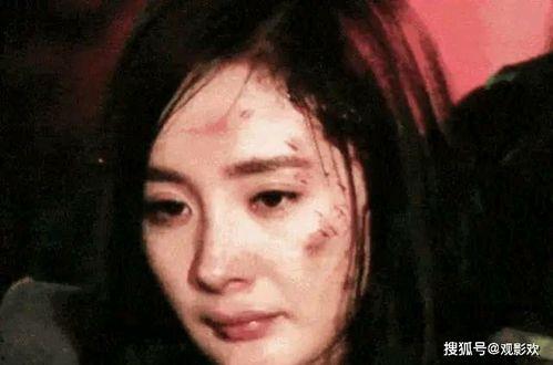 明星  按键受伤,揭秘明星日常生活中的意外瞬间”