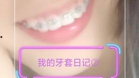 终生戴保持器的明星,揭秘口腔健康与美丽秘诀